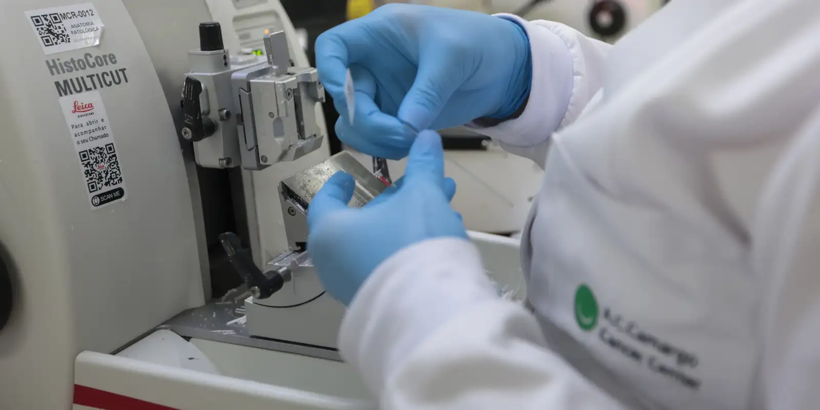 SUS adiciona nova terapia para adultos com leucemia mieloide