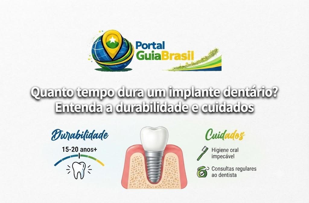 Quanto tempo dura um implante dentário? Entenda a durabilidade e cuidados